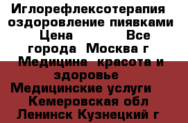 Иглорефлексотерапия, оздоровление пиявками › Цена ­ 3 000 - Все города, Москва г. Медицина, красота и здоровье » Медицинские услуги   . Кемеровская обл.,Ленинск-Кузнецкий г.